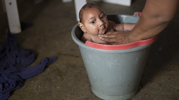 Una mujer baña a su hijo con microcefalia en Brasil.