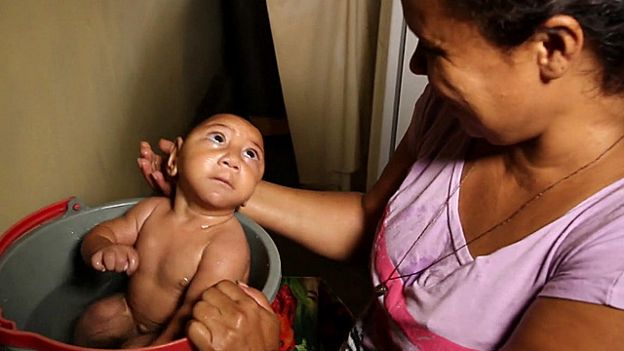 茲卡病毒被認為是導致巴西等南美國家出現大量頭腦發育不全的嬰幼兒病狀的原因，但尚未獲得科學證實。