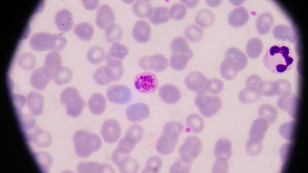 La enfermedad bajo el microscopio
