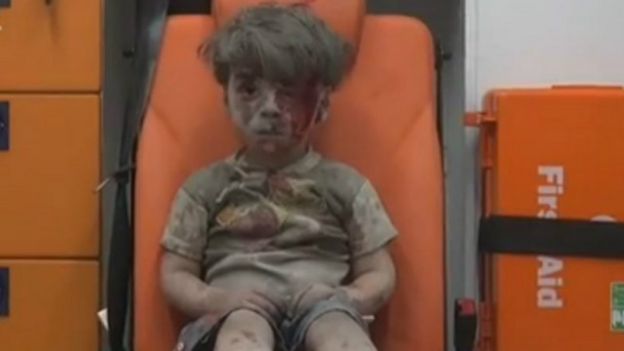 Omran Daqneesh