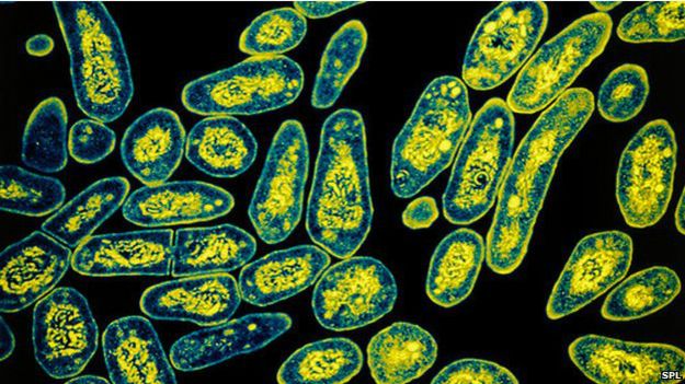 140924115903_tb_bacteria_624x351_c_nocre
