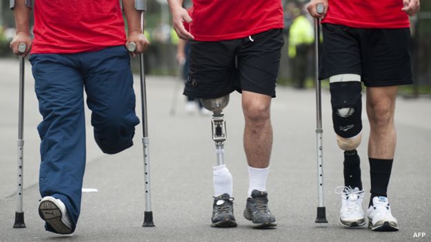 Homens usando próteses | Foto: AFP