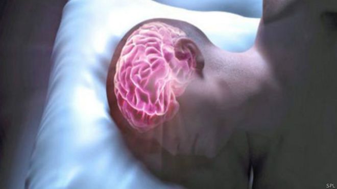 Mapa cerebral do sono | Foto: SPL