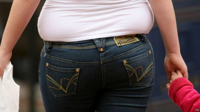 Obesidade (Foto: PA)