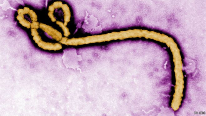 Vírus ebola | Foto: PA CDC