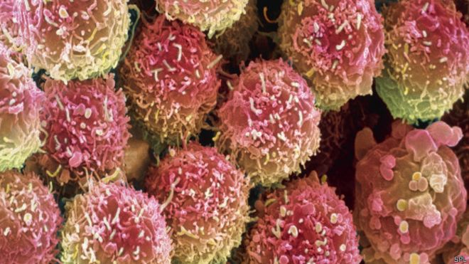 150601130010_cancer_cells_624x351_spl.jp