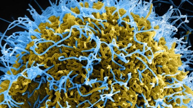 Microbio