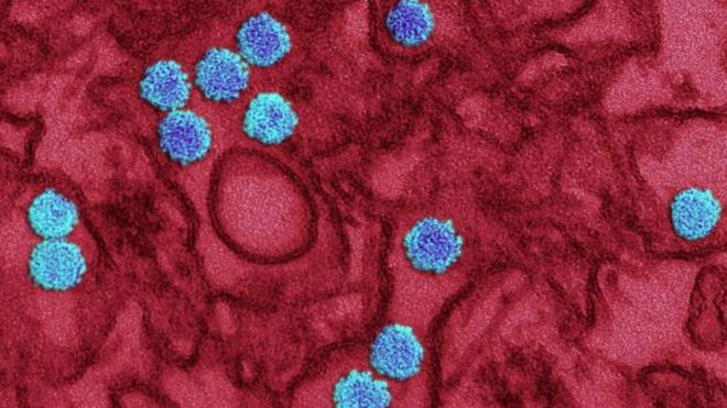 Imagen del virus zika