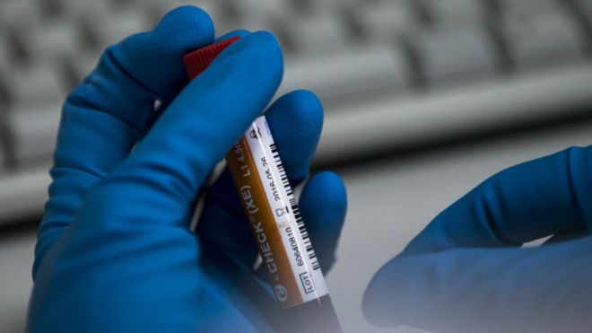 160718134255_russia_doping_640x360_ap_no