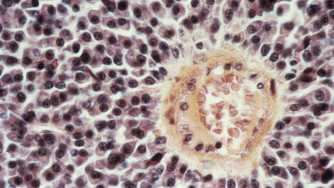 160831142614_cancer_cells_640x360_scienc