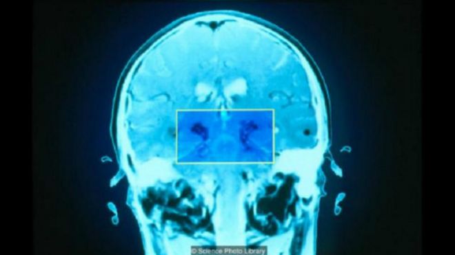 ما أسباب الإرهاق الذهني وكيف تتعامل معه؟