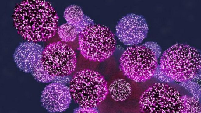 واحد من كل 10 أطفال لديه "جهاز مناعي يصد الإيدز"