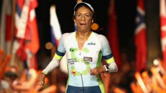 رغم إصابتها بحروق قاتلة، الأسترالية توريا بيت تكمل سباق "ترياثلون" هاواي