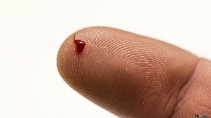 Dedo con gota de sangre.