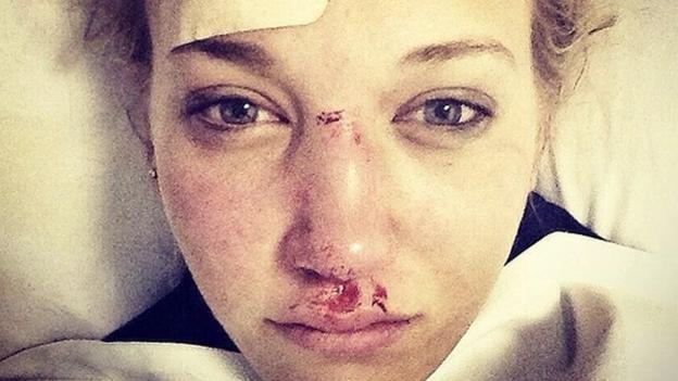 'I couldn't look at my phone without getting migraines' - Cheshire on crash that nearly ended her career