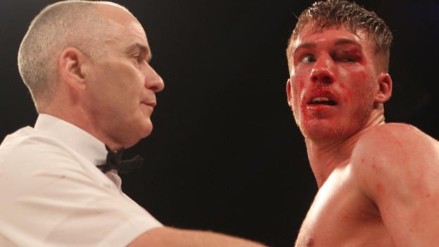 Boxer Blackwell wakes from coma