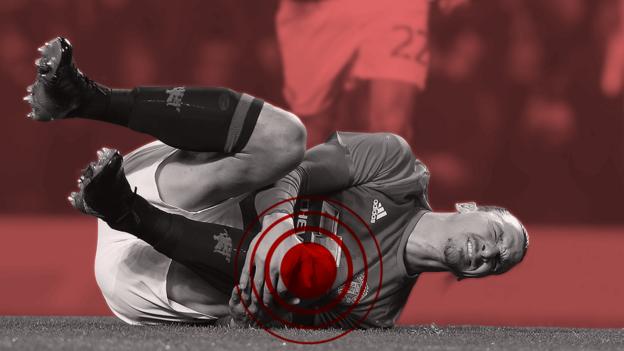 Are serious knee injuries in the Premier League really at 'epidemic' levels?