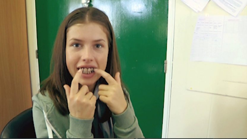 Maddy pointing at her fangs
