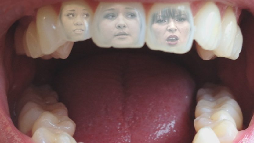 A mouth with 3k teeth.