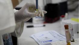 Análisis de sangre en un laboratorio, relacionados con el zika.