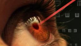 Los daños en la vista causados por punteros láser pueden ser permanentes.
