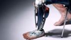 See-through prosthetic leg (Omkaar Kotedia/Alternative Limb Project)