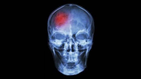 (Thinkstock)