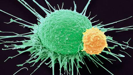 Knowing how to trigger an immune response may help beat cancer (SPL)