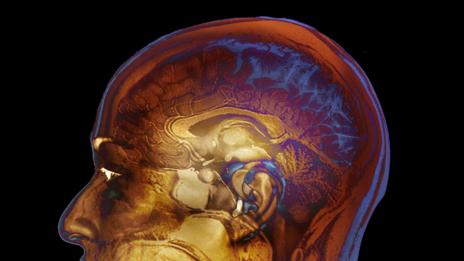 Can you measure a brain by counting neurons? Not really (Credit: SPL) Can you measure a brain by counting neurons? Not really (Credit: SPL)