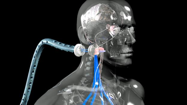 The History and Future of Cyborgs