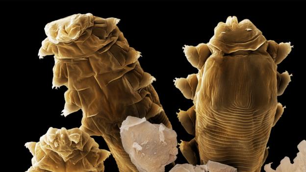 Parasites - PS micrographs