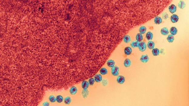 HIV infecting a cell (Credit: Ami Images/Dartmouth College - Louisa Howard/SPL)