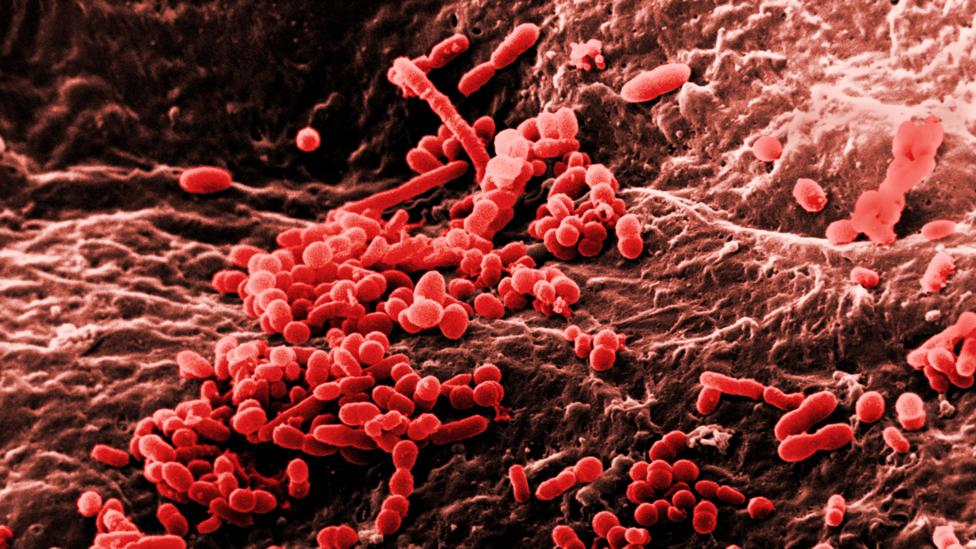 Bacteria are all over your skin (Credit: David M. Phillips/Science Photo Library)