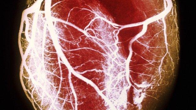 Doctors have stored more than one and a half thousand beating human hearts in digital form on a computer.