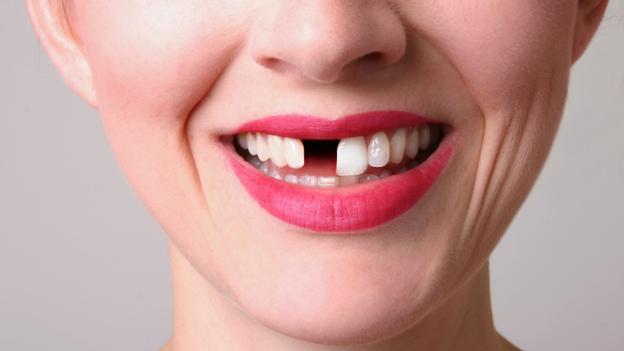 BBC Future Do Brits Really Have Bad Teeth 