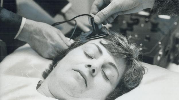 How Shock Therapy Is Saving Some >> Bbc Future The Surprising Benefits Of Electroconvulsive Therapy How Shock Therapy Is Saving Some >> Bbc Future The Surprising Benefits Of Electroconvulsive Therapy