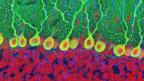 Brain slice (copyright SPL)