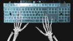 X-ray of hands on keyboard (Copyright: Thinkstock)
