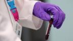 London 2012 doping lab (Copyright: Getty Images)