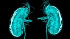 3D printed kidneys