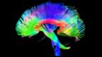 Brain scan (Copyright: SPL)