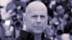 Are bald men more virile?