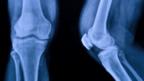 Cartilage made using hybrid 3D printer