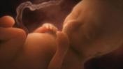 Foetus (Copyright: SPL)