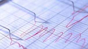 Polygraph test (copyright: SPL)