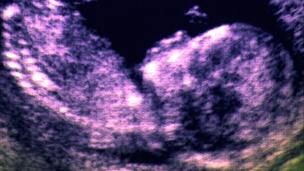 Ultrasound scan