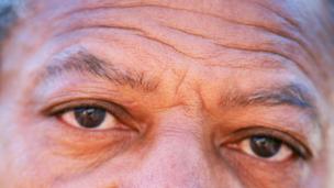 Is black skin less likely to wrinkle?