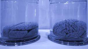 Autism: Banking on new brain donors
