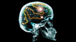 Best of the web: Brain switches and bad drugs