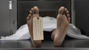 Cadaver on autopsy table (Copyright: Thinkstock)